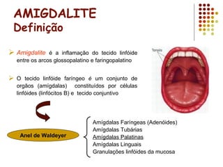 AMIGDALITE
Definição
 Amigdalite é a inflamação do tecido linfóide
entre os arcos glossopalatino e faringopalatino
 O tecido linfóide faríngeo é um conjunto de
orgãos (amígdalas) constituídos por células
linfóides (linfócitos B) e tecido conjuntivo
Amígdalas Faríngeas (Adenóides)
Amígdalas Tubárias
Amígdalas Palatinas
Amígdalas Linguais
Granulações linfóides da mucosa
Anel de Waldeyer
 