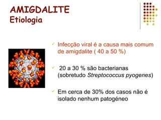 AMIGDALITE
Etiologia
 Infecção viral é a causa mais comum
de amigdalite ( 40 a 50 %)
 20 a 30 % são bacterianas
(sobretudo Streptococcus pyogenes)
 Em cerca de 30% dos casos não é
isolado nenhum patogéneo
 