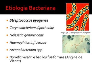 Amigdaliteaguda30% bacterianaStreptococcus pyogenes (Grupo A beta-hemolitico): potencialparaseqüelas