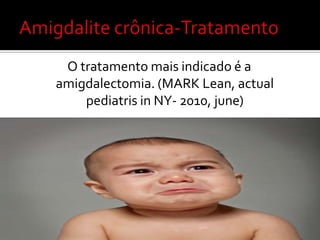 Fazer a colheita com uma zaragatoa seca, colher o exsudado da faringe posterior ou amígdalas, sem tocar nas paredes da cavidade bucal, língua ou úvula