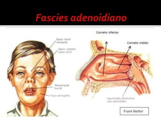 Guia Prático para Manejo no Ambulatório, na Emergência e na Enfermaria- SBP 2009