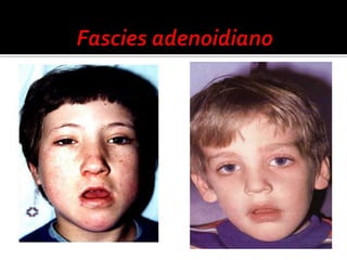 Guia Prático para Manejo no Ambulatório, na Emergência e na Enfermaria- SBP 2009