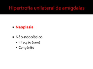 Hipertrofiaobstrutiva  de amigdalas e adenóidesTratamentocirúrgicoamigdalectomia