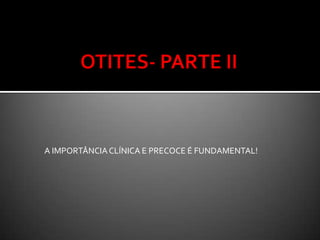 Hipertrofiaobstrutiva  de amigdalas e adenóidesTratamentocirúrgicoamigdalectomia