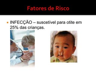 Amigdalectomia- Indicações> 3 episódiosanuaisHipertrofiaobstrutiva (apnéianoturna)Halitose ?Suspeita de neoplasia