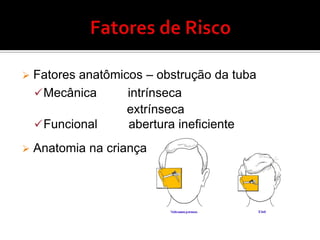 Hiperplasia de Adenóide- TratamentoAdenoidectomia(obstruçõesmaioresque 50% do cavum)Corticóidetópico intranasal por 6-8 semanas (ex: desonida).