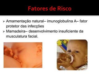 Hipertrofia unilateral de amígdalasNeoplasiaNão-neoplásico: Infecção (raro) Congênito