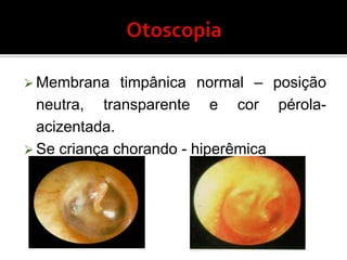 OTITES- PARTE IIA IMPORTÂNCIA CLÍNICA E PRECOCE É FUNDAMENTAL!