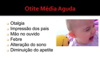 Fatores de RiscoFatores anatômicos – obstrução da tuba
