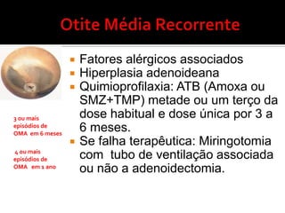 Mecânica         intrínseca                           extrínsecaFuncional         abertura ineficiente 
