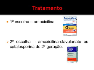 Mamadeira– desenvolvimento insuficiente da musculatura facial.Fatores de RiscoCreches – aumento de infecções das vias aéreas superiores.