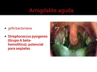 Etiologia viral ou bacteriana