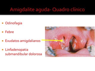 Agente bacteriano mais frequente: