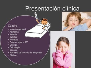 Presentación clínica
Cuadro
• Malestar general
• Adinamia
• Astenia
• Cefalea
• Anorexia
• Fiebre mayor a 30º
• Disfagia
• Odinofagia
• Disfonia
• Aumento de tamaño de amígdalas
• Otalgia
 