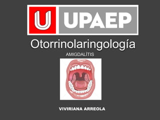 Otorrinolaringología
AMIGDALÌTIS
VIVIRIANA ARREOLA
 