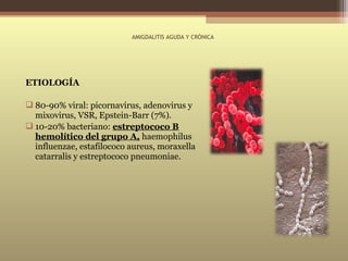 Amigdalitis | PPT