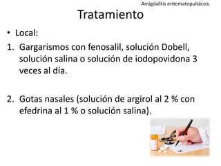 Amigdalitis | PPTX