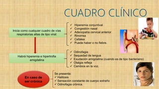 Se presenta:
 Halitosis
 Sensación constante de cuerpo extraño
 Odinofagia crónica.
Inicia como cualquier cuadro de vías
respiratorias altas de tipo viral:
 Hiperemia conjuntival
 Congestión nasal
 Adenopatía cervical anterior
 Rinorrea
 Cefalea
 Puede haber o no fiebre.
Habrá hiperemia e hipertrofia
amigdalina
 Odinofagia
 Sequedad de lengua
 Exudación amigdalina (cuando es de tipo bacteriano)
 Otalgia refleja
 Cambios en la voz.
En caso de
ser crónica
 