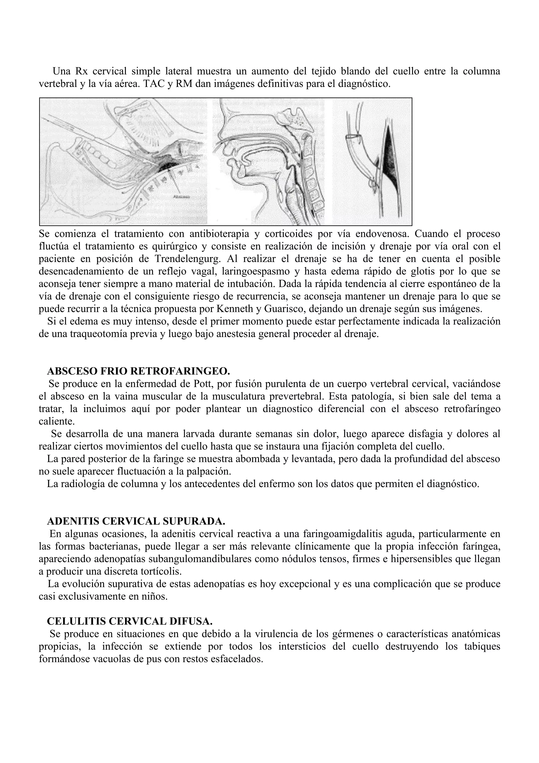 Una Rx cervical simple lateral muestra un aumento del tejido blando del cuello entre la columna
vertebral y la vía aérea. TAC y RM dan imágenes definitivas para el diagnóstico.




Se comienza el tratamiento con antibioterapia y corticoides por vía endovenosa. Cuando el proceso
fluctúa el tratamiento es quirúrgico y consiste en realización de incisión y drenaje por vía oral con el
paciente en posición de Trendelengurg. Al realizar el drenaje se ha de tener en cuenta el posible
desencadenamiento de un reflejo vagal, laringoespasmo y hasta edema rápido de glotis por lo que se
aconseja tener siempre a mano material de intubación. Dada la rápida tendencia al cierre espontáneo de la
vía de drenaje con el consiguiente riesgo de recurrencia, se aconseja mantener un drenaje para lo que se
puede recurrir a la técnica propuesta por Kenneth y Guarisco, dejando un drenaje según sus imágenes.
  Si el edema es muy intenso, desde el primer momento puede estar perfectamente indicada la realización
de una traqueotomía previa y luego bajo anestesia general proceder al drenaje.


  ABSCESO FRIO RETROFARINGEO.
   Se produce en la enfermedad de Pott, por fusión purulenta de un cuerpo vertebral cervical, vaciándose
el absceso en la vaina muscular de la musculatura prevertebral. Esta patología, si bien sale del tema a
tratar, la incluimos aquí por poder plantear un diagnostico diferencial con el absceso retrofaríngeo
caliente.
   Se desarrolla de una manera larvada durante semanas sin dolor, luego aparece disfagia y dolores al
realizar ciertos movimientos del cuello hasta que se instaura una fijación completa del cuello.
  La pared posterior de la faringe se muestra abombada y levantada, pero dada la profundidad del absceso
no suele aparecer fluctuación a la palpación.
  La radiología de columna y los antecedentes del enfermo son los datos que permiten el diagnóstico.


  ADENITIS CERVICAL SUPURADA.
   En algunas ocasiones, la adenitis cervical reactiva a una faringoamigdalitis aguda, particularmente en
las formas bacterianas, puede llegar a ser más relevante clínicamente que la propia infección faríngea,
apareciendo adenopatías subangulomandibulares como nódulos tensos, firmes e hipersensibles que llegan
a producir una discreta tortícolis.
  La evolución supurativa de estas adenopatías es hoy excepcional y es una complicación que se produce
casi exclusivamente en niños.

  CELULITIS CERVICAL DIFUSA.
   Se produce en situaciones en que debido a la virulencia de los gérmenes o características anatómicas
propicias, la infección se extiende por todos los intersticios del cuello destruyendo los tabiques
formándose vacuolas de pus con restos esfacelados.
 