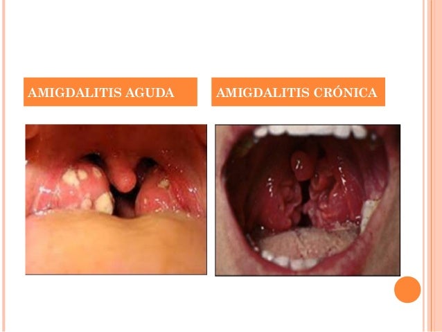 Can you delete facebook dating account