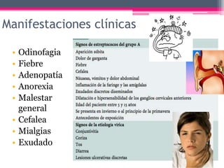 Manifestaciones clínicas
• Odinofagia
• Fiebre
• Adenopatía
• Anorexia
• Malestar
general
• Cefalea
• Mialgias
• Exudado