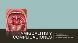 AMIGDALITIS Y
COMPLICACIONES

Servicio de
Otorrinolaringología
Dr. Alan Burgos P. R1 ORL

 