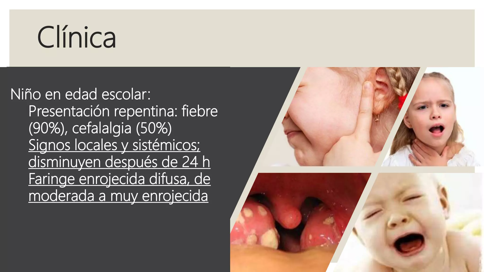 Clínica
◦ Lactantes (tres meses a un año):
◦ Irritables pero no agudamente
enfermos
◦ Fiebre baja e irregular
◦ Secreción nasal serosa
◦ Narinas excoriadas
◦ Respuesta espectacular a la
penicilina
Niño preescolar (1 a 4 años):
Fiebre, vómito, dolor abdominal
Habla nasal sin rinorrea mucoide
Mal aliento característico
Secreción mucoide posnasal
Enrojecimiento faríngeo difuso
Dolor al abrir la boca
Ganglios cervicales anteriores
dolorosos
Es común la otitis media
Niño en edad escolar:
Presentación repentina: fiebre
(90%), cefalalgia (50%)
Signos locales y sistémicos;
disminuyen después de 24 h
Faringe enrojecida difusa, de
moderada a muy enrojecida
 