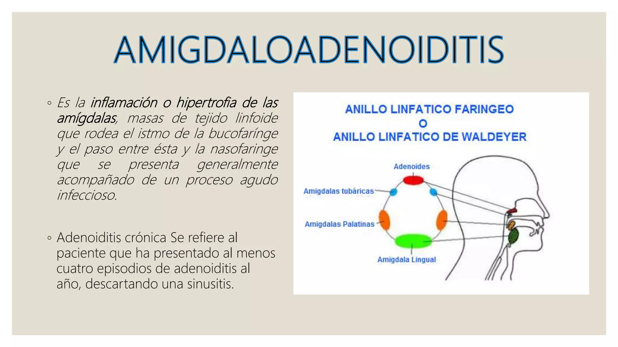 ◦ Es la inflamación o hipertrofia de las
amígdalas, masas de tejido linfoide
que rodea el istmo de la bucofarínge
y el paso entre ésta y la nasofaringe
que se presenta generalmente
acompañado de un proceso agudo
infeccioso.
◦ Adenoiditis crónica Se refiere al
paciente que ha presentado al menos
cuatro episodios de adenoiditis al
año, descartando una sinusitis.
 