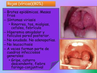 – Brotes epidémicos. Meses
frios
– Síntomas viriasis
• Rinorrea, tos, mialgias,
cefalea, febrícula
– Hiperemia amigdalar y
folículos pared posterior.
– No exudado. No adenopatías.
– No leucocitosis
– A veces forman parte de
cuadros infecciosos
generales:
• Gripe, catarro
descendente, fiebre
faringo-conjuntival
Rojas (víricas)(80%)
 