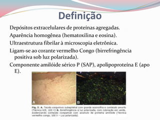 Definição
Depósitos extracelulares de proteínas agregadas.
Aparência homogênea (hematoxilina e eosina).
Ultraestrutura fibrilar à microscopia eletrônica.
Ligam-se ao corante vermelho Congo (birrefringência
positiva sob luz polarizada).
Componente amilóide sérico P (SAP), apolipoproteína E (apo
E).
 