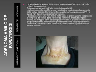 TERAPIADELL’ADENOMAINTERVENTOMARZO2011
 La terapia dell’adenoma è chirurgica e consiste nell’asportazione della
ghiandola neoplastica.
Esistono due varianti dell’adenoma delle paratiroidi:
- Adenoma ossifilo: proliferazione neoplastica costituita esclusivamente
dalle cellule ossifile. Generalmente questi tumori non producono PTH e
quindi non determinano iperparatiroidismo.
- Lipoadenoma: è una rara forma nella quale la proliferazione neoplastica
è composta da cellule della paratiroide commiste a tessuto adiposo
maturo. La maggior parte dei casi producono PTH e quindi determinano
iperparatiroidismo. Sinonimi del lipoadenoma sono: lipoiperplasia della
paratiroide, amartoma della paratiroide, adenoma della paratiroide con
stroma mixoide.
 