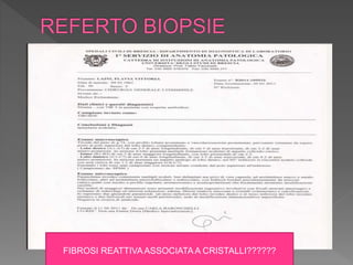 FIBROSI REATTIVAASSOCIATA A CRISTALLI??????
 