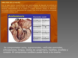 Se comprometen aorta, suprarrenales, vesículas seminales, articulaciones, lengua, islotes de Langerhans, hipófisis, encéfalo y corazón. El compromiso cardíaco puede llevar a la muerte. 