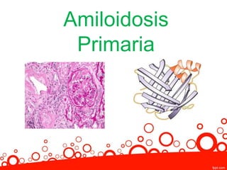Amiloidosis
Primaria
 