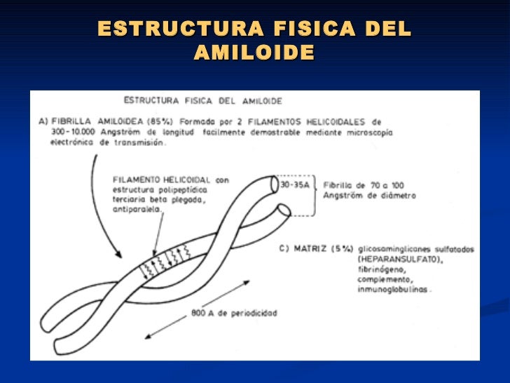 enfermedad de cadenas ligeras pdf amiloidosis renal enfermedad de cadenas ligeras pdf amiloidosis renal