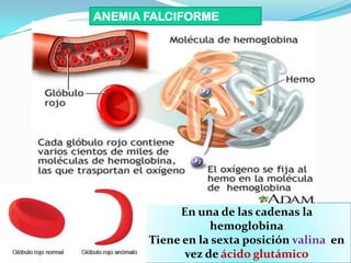 En una de las cadenas la
hemoglobina
Tiene en la sexta posición valina en
vez de ácido glutámico
ANEMIA FALCIFORME
 