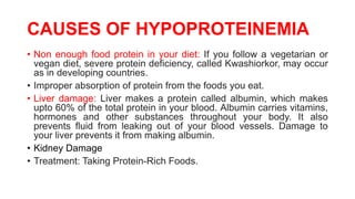 CAUSES OF HYPOPROTEINEMIA
• Non enough food protein in your diet: If you follow a vegetarian or
vegan diet, severe protein deficiency, called Kwashiorkor, may occur
as in developing countries.
• Improper absorption of protein from the foods you eat.
• Liver damage: Liver makes a protein called albumin, which makes
upto 60% of the total protein in your blood. Albumin carries vitamins,
hormones and other substances throughout your body. It also
prevents fluid from leaking out of your blood vessels. Damage to
your liver prevents it from making albumin.
• Kidney Damage
• Treatment: Taking Protein-Rich Foods.
 