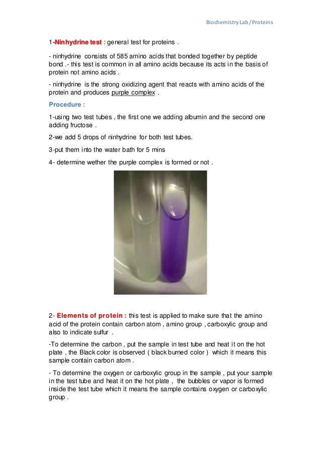 Tests for proteins Biochemistry lab
