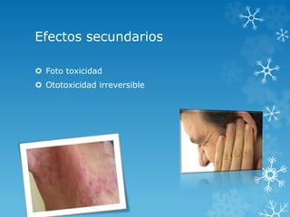 Efectos secundarios 
 Foto toxicidad 
 Ototoxicidad irreversible 
 