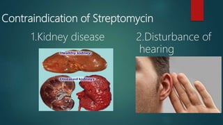 Contraindication of Streptomycin
1.Kidney disease 2.Disturbance of
hearing
 