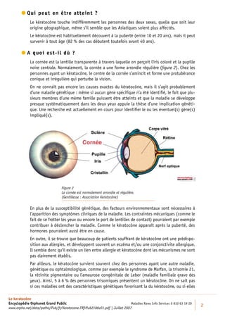  ui peut en être atteint ?
          Q
             Le kératocône touche indifféremment les personnes des deux sexes, quelle que soit leur
             origine géographique, même s’il semble que les Asiatiques soient plus affectés.
             Le kératocône est habituellement découvert à la puberté (entre 10 et 20 ans), mais il peut
             survenir à tout âge (82 % des cas débutent toutefois avant 40 ans).

         quoi est-il dû ?
          A
             La cornée est la lentille transparente à travers laquelle on perçoit l’iris coloré et la pupille
             noire centrale. Normalement, la cornée a une forme arrondie régulière (ﬁgure 2). Chez les
             personnes ayant un kératocône, le centre de la cornée s’amincit et forme une protubérance
             conique et irrégulière qui perturbe la vision.
             On ne connaît pas encore les causes exactes du kératocône, mais il s’agit probablement
             d’une maladie génétique : même si aucun gène spéciﬁque n’a été identiﬁé, le fait que plu-
             sieurs membres d’une même famille puissent être atteints et que la maladie se développe
             presque systématiquement dans les deux yeux appuie la thèse d’une implication généti-
             que. Une recherche est actuellement en cours pour identiﬁer le ou les éventuel(s) gène(s)
             impliqué(s).




                                  Figure 2
                                  La cornée est normalement arrondie et régulière.
                                  (Gentillesse : Association Keratocône)


             En plus de la susceptibilité génétique, des facteurs environnementaux sont nécessaires à
             l’apparition des symptômes cliniques de la maladie. Les contraintes mécaniques (comme le
             fait de se frotter les yeux ou encore le port de lentilles de contact) pourraient par exemple
             contribuer à déclencher la maladie. Comme le kératocône apparaît après la puberté, des
             hormones pourraient aussi être en cause.
             En outre, il se trouve que beaucoup de patients souffrant de kératocône ont une prédispo-
             sition aux allergies, et développent souvent un eczéma et/ou une conjonctivite allergique.
             Il semble donc qu’il existe un lien entre allergie et kératocône dont les mécanismes ne sont
             pas clairement établis.
             Par ailleurs, le kératocône survient souvent chez des personnes ayant une autre maladie,
             génétique ou ophtalmologique, comme par exemple le syndrome de Marfan, la trisomie 21,
             la rétinite pigmentaire ou l’amaurose congénitale de Leber (maladie familiale grave des
             yeux). Ainsi, 5 à 6 % des personnes trisomiques présentent un kératocône. On ne sait pas
             si ces maladies ont des caractéristiques génétiques favorisant la du kératocône, ou si elles

Le keratocône
Encyclopédie Orphanet Grand Public                                          Maladies Rares Info Services 0 810 63 19 20
                                                                                                                          2
www.orpha.net/data/patho/Pub/fr/Keratocone-FRfrPub2186v01.pdf | Juillet 2007
 