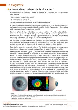 Le diagnostic
         omment fait-on le diagnostic du kératocône ?
          C
             L’ophtalmologiste va s’attacher à mettre en évidence les trois altérations caractéristiques
             de la maladie:
             - l’astigmatisme irrégulier et évolutif,
             - la forme en cône de la cornée,
             - la présence éventuelle d’opacités ou de cicatrices cornéennes.
             Il est difﬁcile de diagnostiquer précocement un kératocône. En effet, les modiﬁcations vi-
             suelles sont peu importantes au début de la maladie, et elles s’apparentent à des troubles
             de la vision classiques (astigmatisme, myopie).
             L’examen ophtalmologique met d’abord en évidence une baisse d’acuité visuelle se tradui-
             sant par une capacité moindre à distinguer les détails et les formes des objets à une cer-
             taine distance, et la perception d’images légèrement tordues ou déformées (astigmatisme
             irrégulier). Rapidement, une myopie va s’associer à l’astigmatisme.
             Les personnes atteintes de kératocône ont besoin de consulter souvent leur ophtalmolo-
             giste, parce que leurs lunettes deviennent vite inadaptées. En effet, leur prescription peut
             changer plusieurs fois en l’espace de 12 à 18 mois, car l’inconfort visuel persiste.
             Pour déceler de manière certaine la présence d’un kératocône, même dans sa forme précoce,
             et conﬁrmer le diagnostic, une carte topographique de la cornée doit être réalisée.
             La topographie cornéenne (ﬁgure 4) est un examen qui permet de relever les rayons de
             courbure à différents endroits de la cornée, un peu comme on évalue le relief d’une mon-
             tagne. Cet examen permet de connaître la forme précise de la cornée, et de suivre son
             évolution. Cette étude de la topographie cornéenne se fait par vidéotopographie (ou vi-
             déokératographie), technique qui consiste à projeter des cercles de lumière concentriques
             sur la cornée. Sur la cornée conique, ces cercles prennent une forme ovale ou irrégulière,
             la déformation et l’écartement étant variables selon les différentes zones de la cornée
             (les déformations les plus importantes correspondent au sommet du cône). Une caméra
             vidéo saisit l’image de ce disque reﬂétée par la cornée, puis les données sont numérisées
             pour obtenir la géométrie en trois dimensions de la cornée (sorte de « photographie en
             relief »). De nouveaux systèmes d’imagerie (Orbscan) permettent aujourd’hui de déterminer
             l’épaisseur de tous les points de la cornée en cartographiant à la fois la surface antérieure




               Figure 4
               Topographie d’un kératocône : au centre, les couleurs rouge et jaune mettent en évidence un bombement
               de la cornée correspondant au cône (décentré, ici)
               (Gentillesse : Association Keratocône)


Le keratocône
Encyclopédie Orphanet Grand Public                                          Maladies Rares Info Services 0 810 63 19 20
                                                                                                                          5
www.orpha.net/data/patho/Pub/fr/Keratocone-FRfrPub2186v01.pdf | Juillet 2007
 