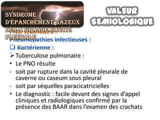 Syndrome
d’épanchement gazeux
de la grande cavité
pleurale

  Tuberculose pulmonaire :
 • Le PNO résulte
 - soit par rupture dans la cavité pleurale de
   caverne ou caseum sous pleural
 - soit par séquelles paracicatricielles
 • Le diagnostic : facile devant des signes d’appel
   cliniques et radiologiques confirmé par la
   présence des BAAR dans l’examen des crachats
 