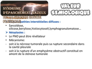 Syndrome
d’épanchement gazeux
de la grande cavité
pleurale
 • Sarcoïdose,
   silicose,beryliose,histiocytoseX,lymphogranulomatose…

 • Le PNO peut être révélateur
 • Mécanisme:
 - soit à la nécrose tumorale puis sa rupture secondaire dans
   la cavité pleurale
 - soit à la rupture d’un emphysème obstructif constitué en
   amont de la sténose tumorale
 
