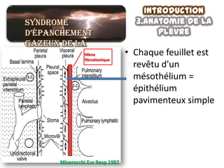 Introduction
Syndrome                               3.anatomie de la
d’épanchement                               plèvre
gazeux de la
grande cavité
            Mbne                     • Chaque feuillet est
            fibroélastique
pleurale                               revêtu d'un
                                       mésothélium =
                                       épithélium
                                       pavimenteux simple




          Miserocchi Eur Resp 1997
 