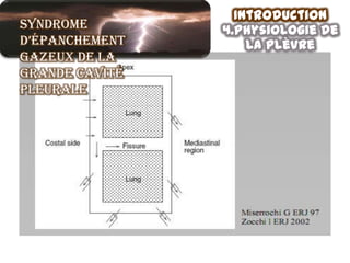 Introduction
Syndrome        4.physiologie de
d’épanchement       la plèvre
gazeux de la
grande cavité
pleurale
 