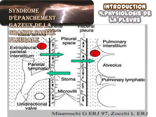 Introduction
Syndrome        4.physiologie de
d’épanchement       la plèvre
gazeux de la
grande cavité
pleurale
 