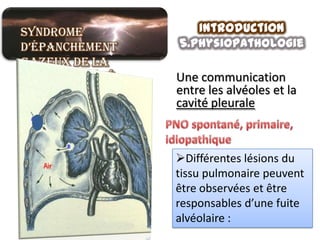 Syndrome           Introduction
d’épanchement   5.physiopathologie
gazeux de la
grande cavité   Une communication
pleurale        entre les alvéoles et la
                cavité pleurale



                Différentes lésions du
                tissu pulmonaire peuvent
                être observées et être
                responsables d’une fuite
                alvéolaire :
 