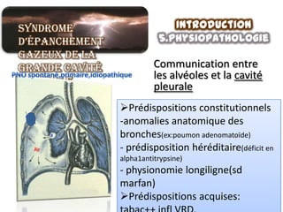 Syndrome                      Introduction
d’épanchement              5.physiopathologie
gazeux de la
grande cavité             Communication entre
                          les alvéoles et la cavité
pleurale                  pleurale
                Prédispositions constitutionnels
                -anomalies anatomique des
                bronches(ex:poumon adenomatoïde)
                - prédisposition héréditaire(déficit en
                alpha1antitrypsine)
                - physionomie longiligne(sd
                marfan)
                Prédispositions acquises:
 