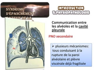 Syndrome           Introduction
d’épanchement   5.physiopathologie
gazeux de la
grande cavité   Communication entre
pleurale        les alvéoles et la cavité
                pleurale



                 plusieurs mécanismes:
                 tous conduisant à la
                rupture de la paroi
                alvéolaire et plèvre
                viscérale déjà fragilisée
 